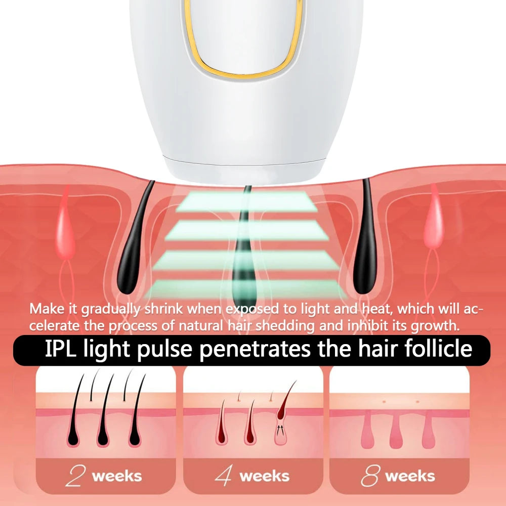 Depiladora Laser IPL Para Piernas